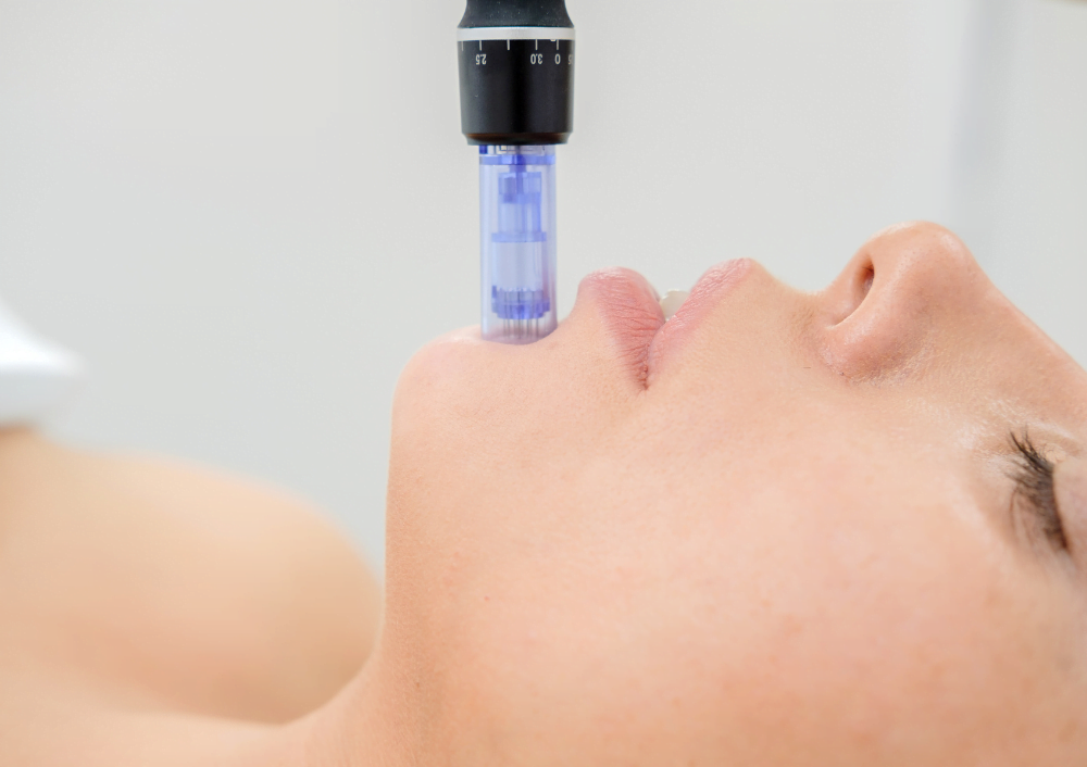 Dermapen